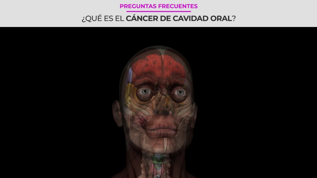 ¿Qué es el cáncer de cavidad oral?