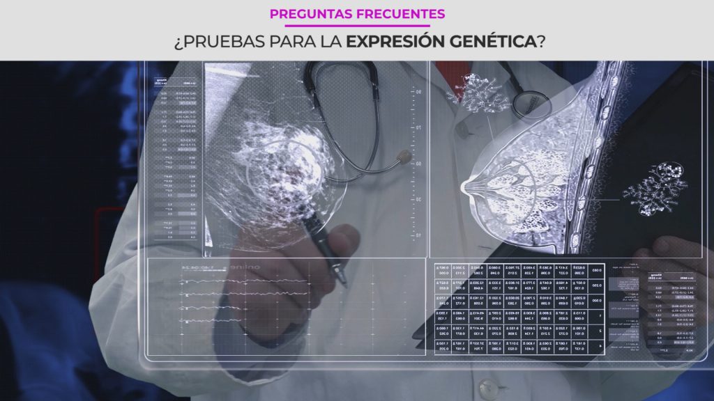 ¿Qué son las pruebas de expresión genética para el cáncer de seno?